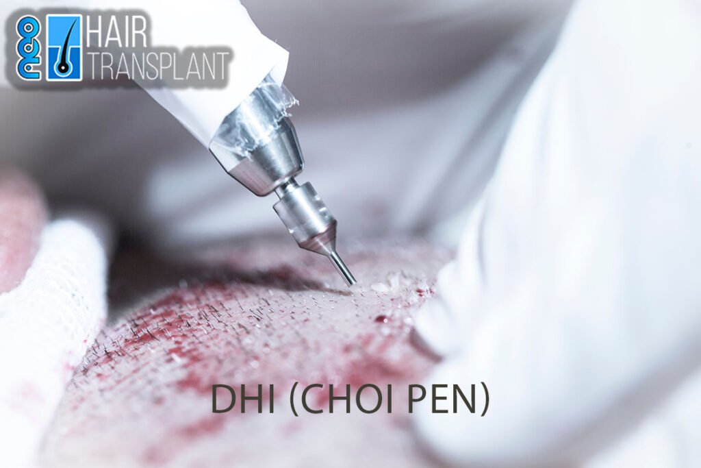 what is dhi hair transplant