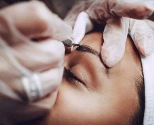 eyebrow transplantation - Neohair eyebrow transplantation - Neohair