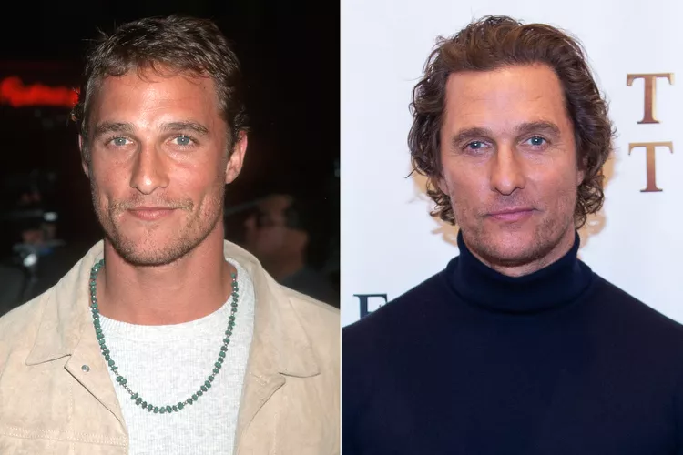 La greffe de cheveux de Matthew McConaughey