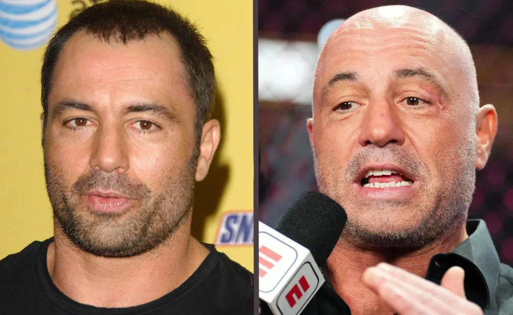 greffe de cheveux joe rogan