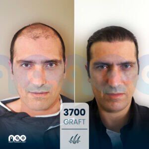 n2
