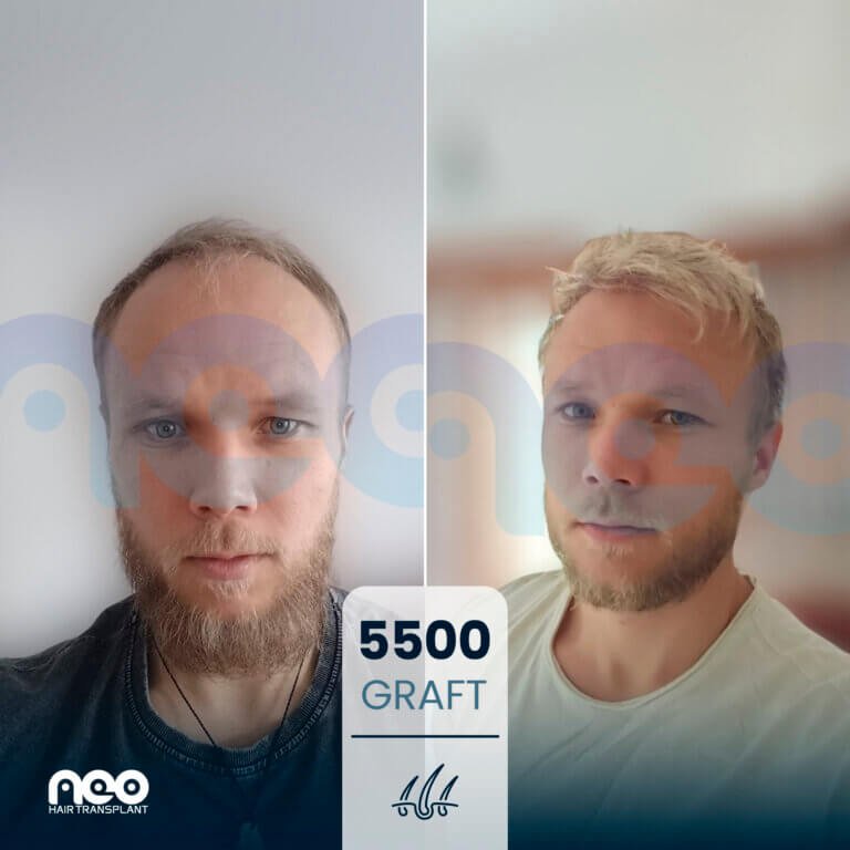 n8